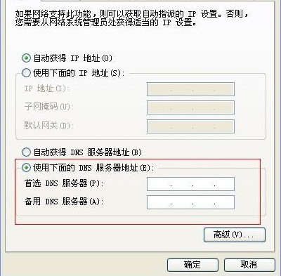 传奇很卡或者服务器慢你可能忽略了DNS1
